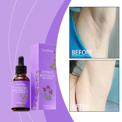 Post-Hair Removal Repair Serum