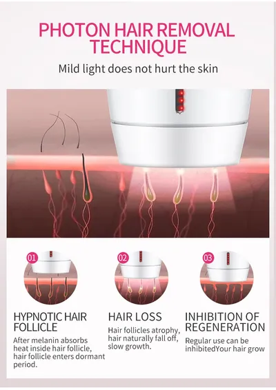 Home laser hair removal instrument