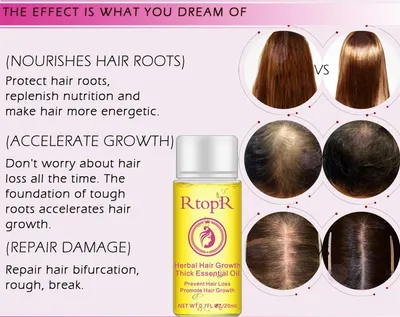 Fast Powerful Hair Growth Products Essential Oil Liquid Treatment Preventing Hair Loss Hair Care 20ml