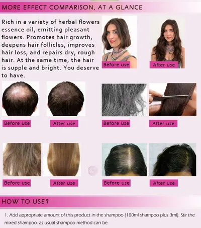 Fast Powerful Hair Growth Products Essential Oil Liquid Treatment Preventing Hair Loss Hair Care 20ml