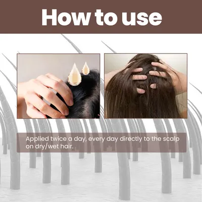 EELHOE Hair Dense Essence Hair Anti-hair Loss And Hair Fixation Nutrition