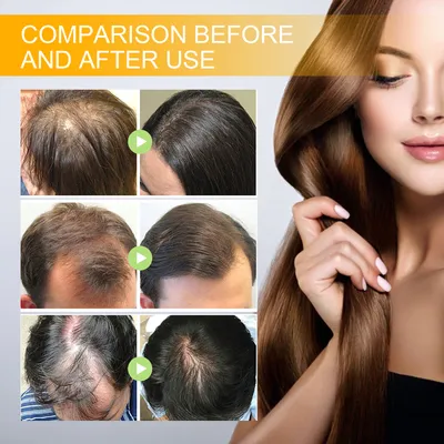 EELHOE Biotin Hair Dense Hair Spray Repair Hair Nourishing Hair Care Hair Fixing Strong And Tough