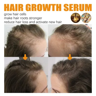 EELHOE Biotin Hair Dense Hair Spray Repair Hair Nourishing Hair Care Hair Fixing Strong And Tough