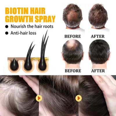 EELHOE Biotin Hair Dense Hair Spray Repair Hair Nourishing Hair Care Hair Fixing Strong And Tough