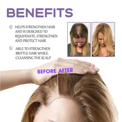 Hair Follicle Dense Hair Drops