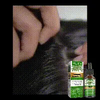 Rosemary Hair Care Essential Oil Anti-loss Hair Growth Hair Care Nourish Scalp Hair Roots