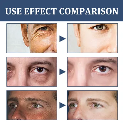 Fading Wrinkle Eye Bags Dark Circles Moisturizing Facial Neck Cream