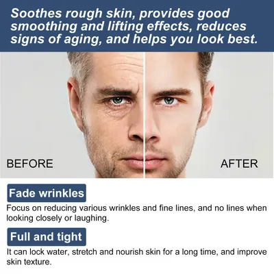 Fading Wrinkle Eye Bags Dark Circles Moisturizing Facial Neck Cream