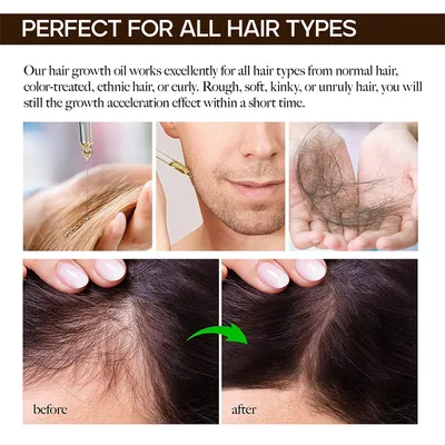 Hair Hair Care Essential Oil 30ml Soft And Refreshing