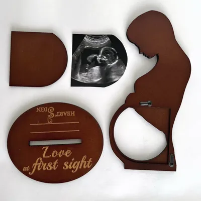 Wooden Crafts Decoration Commemorative Standee Baby Ultrasonic Testing B- Ultrasound Souvenir Photo Frame