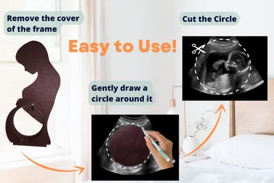 Wooden Crafts Decoration Commemorative Standee Baby Ultrasonic Testing B- Ultrasound Souvenir Photo Frame