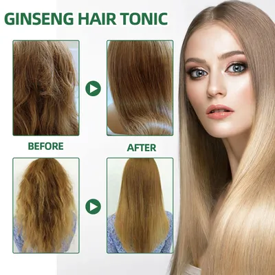 OUHOE Ginseng Hair Growth Lotion Ginseng  Moisturizing Hair Care Hair Growth Spray
