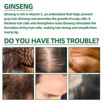 OUHOE Ginseng Hair Growth Lotion Ginseng  Moisturizing Hair Care Hair Growth Spray