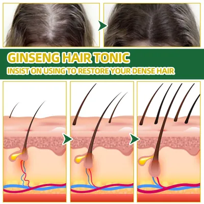 OUHOE Ginseng Hair Growth Lotion Ginseng  Moisturizing Hair Care Hair Growth Spray