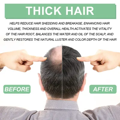كرات تدليك الشعر من ويست آند مونث لتدليك فروة الرأس وترطيب جذور الشعر وتكثيفه وعلاج الشعر بالزيوت العطرية