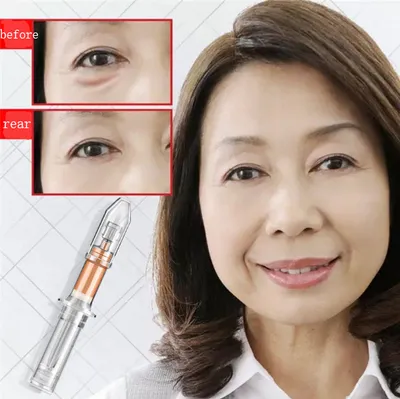Lightening fine lines, dark circles, eye bags, eye cream