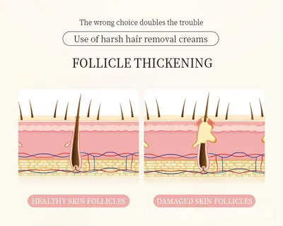 Hair Removal Cream Gentle And Non-Irritating Hair Removal