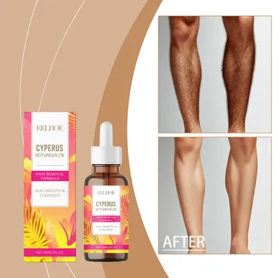 Hair Removal Care Essential Oil